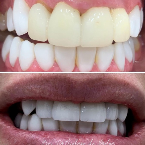 Estética - Dr. Giuliano de Pádua